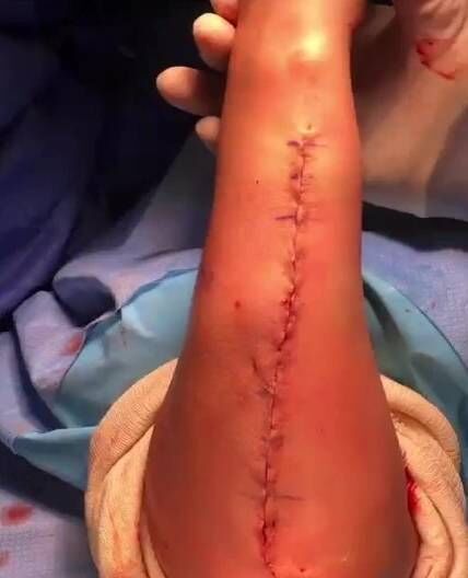 Paige VanZant critica a Instagram por censurar una foto de su brazo...