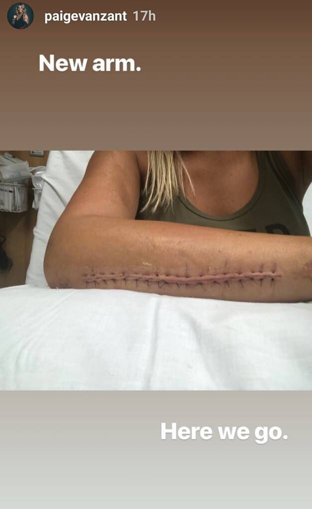 Paige VanZant critic a Instagram por censurar una foto de su brazo...