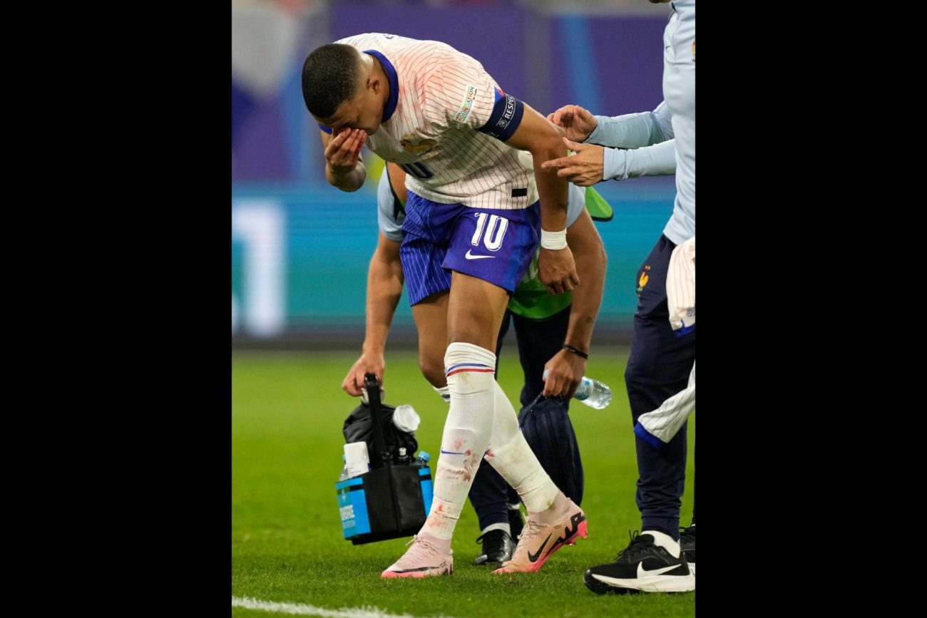 El atacante, ahora del Real Madrid, se impact con un rival y sac...
